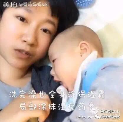 幼儿头垢和湿疹结痂的区别,湿疹洗澡用什么清洗