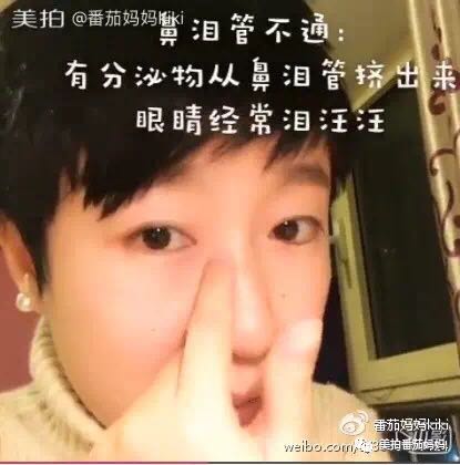 宝宝眼睛都是眼屎粘住了,宝宝眼睛被黄色眼屎糊住