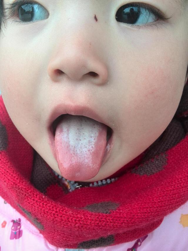 湿气重最好不要吃这些瓜果,只会加重湿气!