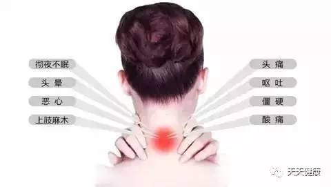 怎么姿势能预防颈椎病,预防颈椎病从纠正不良的姿势做起