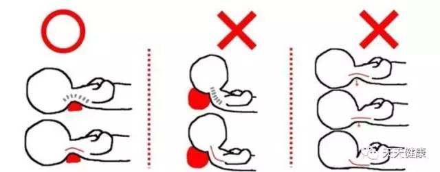 怎么姿势能预防颈椎病,预防颈椎病从纠正不良的姿势做起