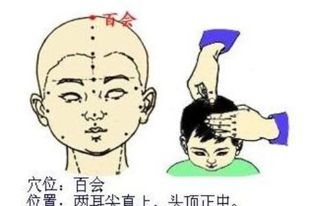 神经性头痛拔罐哪几个穴位,神经性头痛针灸穴位