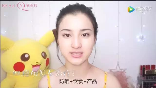 长痘痘的十大原因,什么才是长痘痘的罪魁祸首