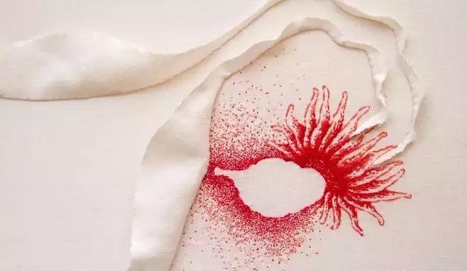 卵巢癌复发及治疗,卵巢癌反复复发该怎么办