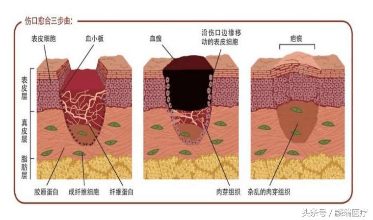 手术后我们应该吃什么？