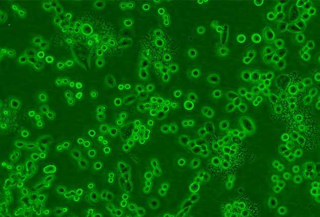 详解霉菌的危害和应对方案