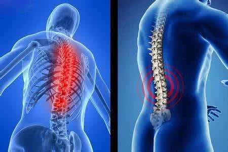 80多岁的老中医秘传膏药,怎样预防慢性骨关节疾病