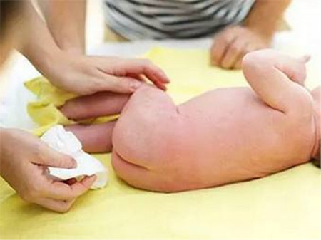 宝宝拉肚子非要吃粥吗,宝宝拉肚子需要喝腹泻奶粉吗