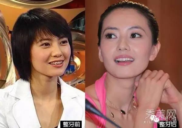 高圆圆被吐槽完整,高圆圆被吐槽