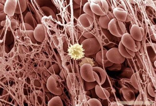 紫癜皮肤出血点会反复出现吗,皮下出血紫癜是什么原因造成