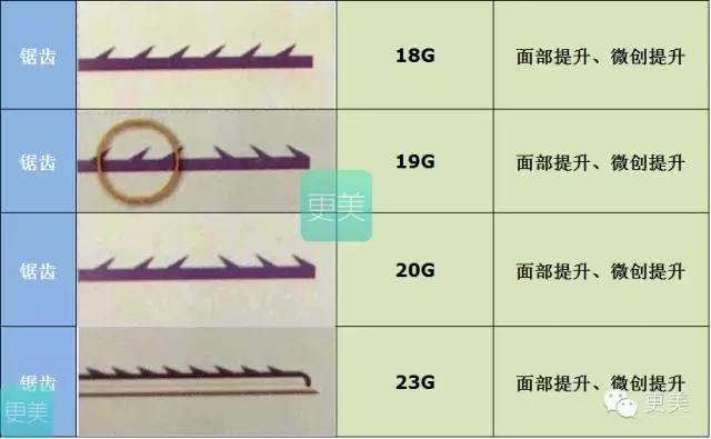 脸部缝美容线好还是普通线好,医院埋线和美容院埋线有什么差别