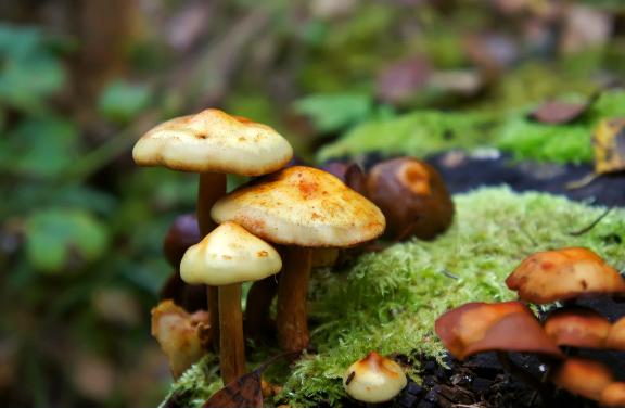 痘痘肌成因图片对照,脸上囊肿型痘痘成因