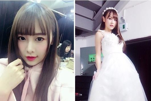 snh48唐安琪烧伤现场图曝光,烧伤女孩唐安琪近况