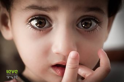 眼部瘙痒疾病的解决方案