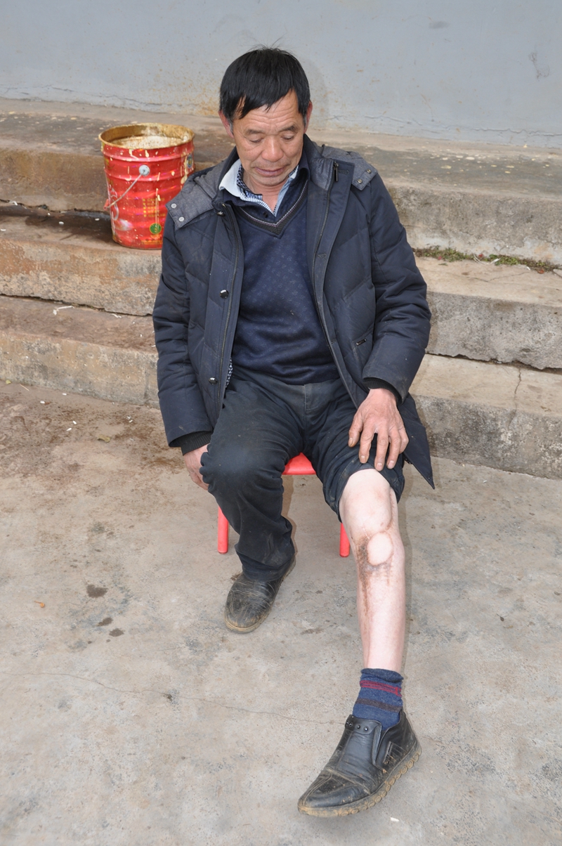 谭德才同志,永善县茂林镇谭德才