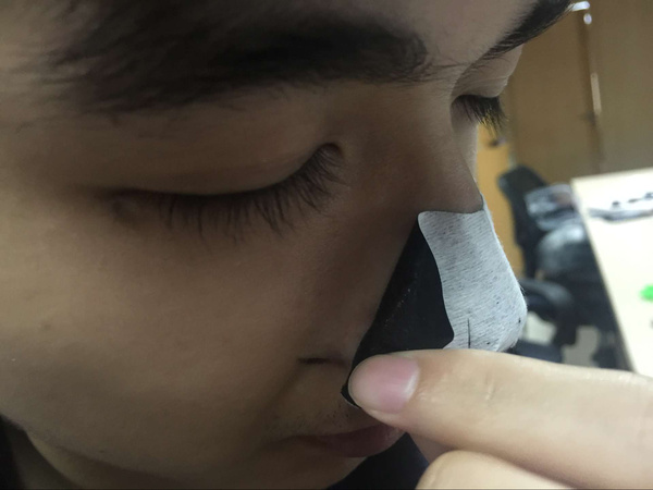 男士去除黑头,男士如何去除黑头的最有效方法