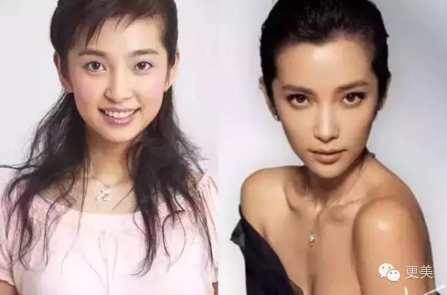 脸部缝美容线好还是普通线好,医院埋线和美容院埋线有什么差别