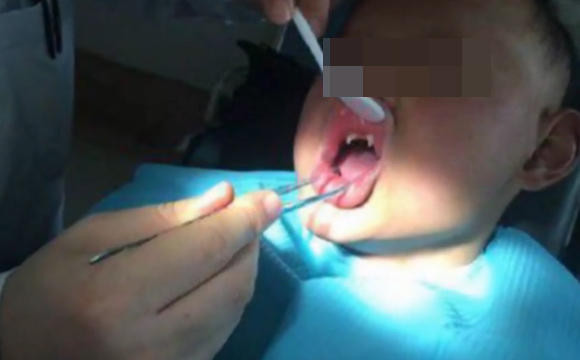 25岁小伙得了罕见病,男子患怪病一睡觉就满口血