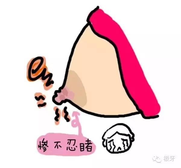 母乳妈妈如何保护乳房,最东西