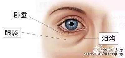 怎么区分眼袋黑眼圈泪沟卧蚕,卧蚕眼袋泪沟黑眼圈