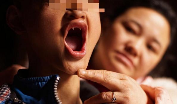 25岁小伙得了罕见病,男子患怪病一睡觉就满口血