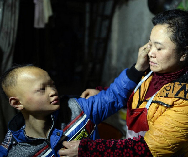 25岁小伙得了罕见病,男子患怪病一睡觉就满口血