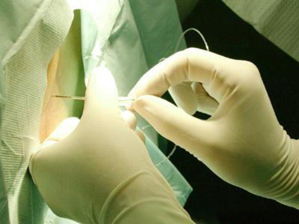 手术前打麻药有什么后遗症,手术前麻醉药过敏严重吗