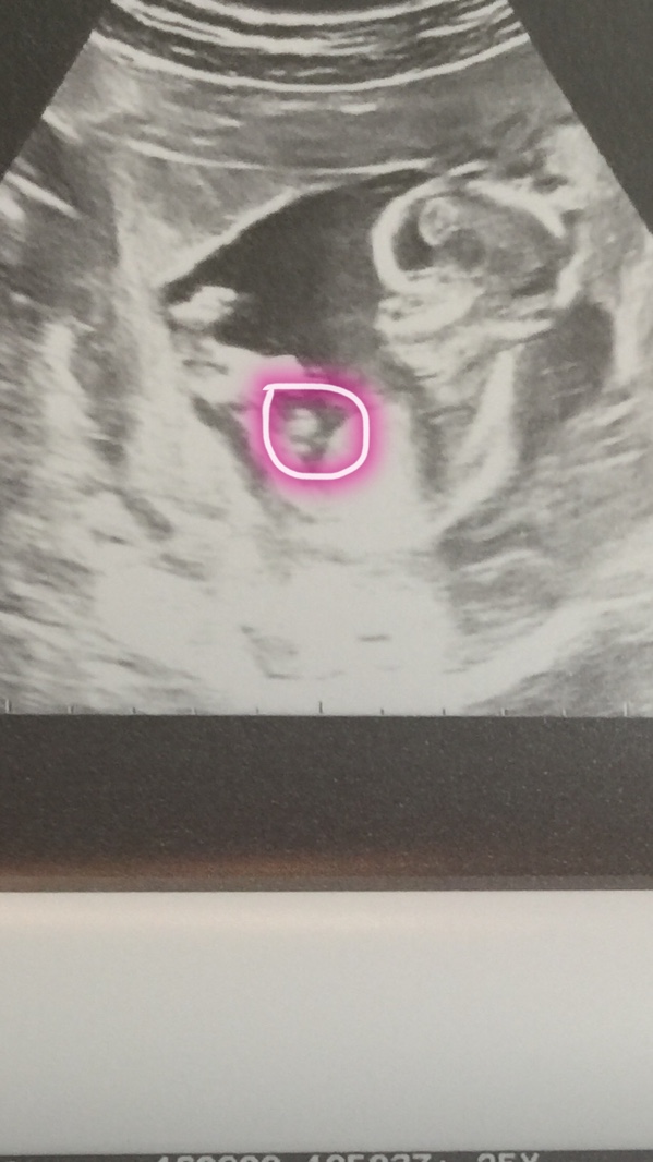 怀孕如何检测孩子dna,女宝宝体检标准