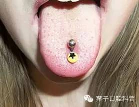 三八专题：女性都该懂的事！#葉子口腔科普#