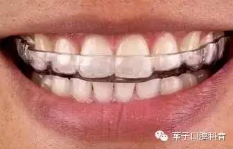 磨牙牙齿坏一半怎么补救,睡觉磨牙怎么用中医治疗