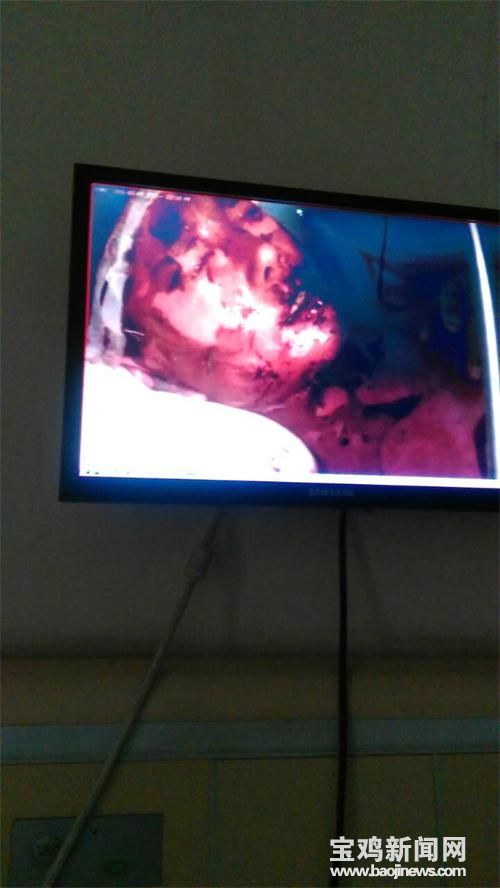 儿童抗疫情捐款,男童患罕见病急求助捐款