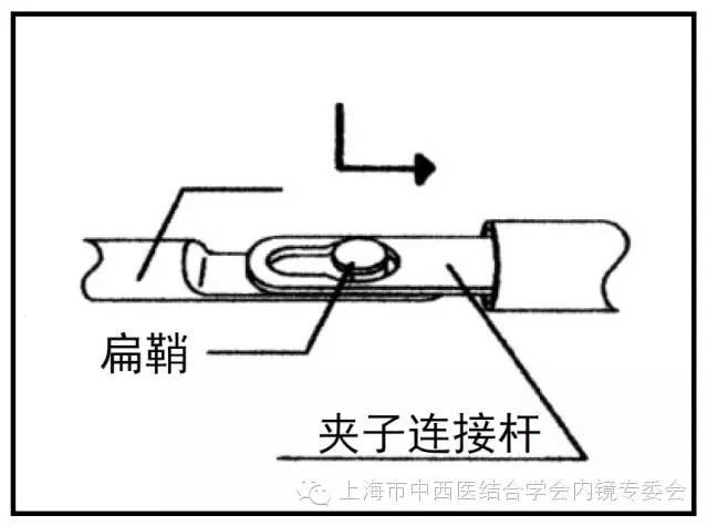 消化内镜护理配合教学视频,消化内镜取样钳