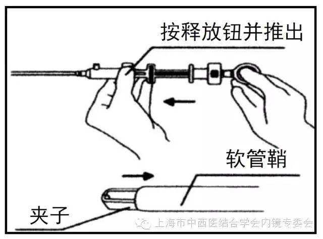 消化内镜护理配合教学视频,消化内镜取样钳