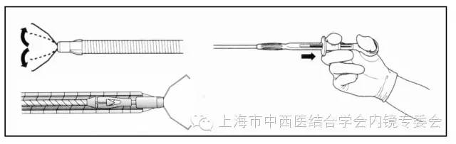 消化内镜护理配合教学视频,消化内镜取样钳