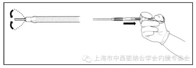 消化内镜护理配合教学视频,消化内镜取样钳