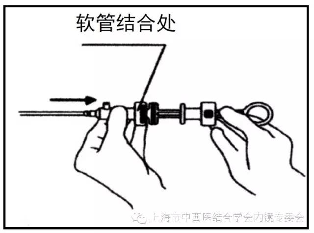 消化内镜护理配合教学视频,消化内镜取样钳