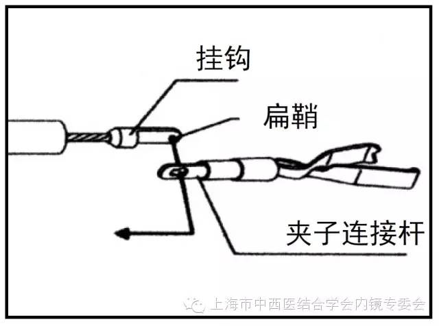 消化内镜护理配合教学视频,消化内镜取样钳