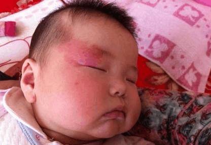 孕妇胎儿胎位不正是怎么办,37周加胎儿未入盆一般几周会入盆