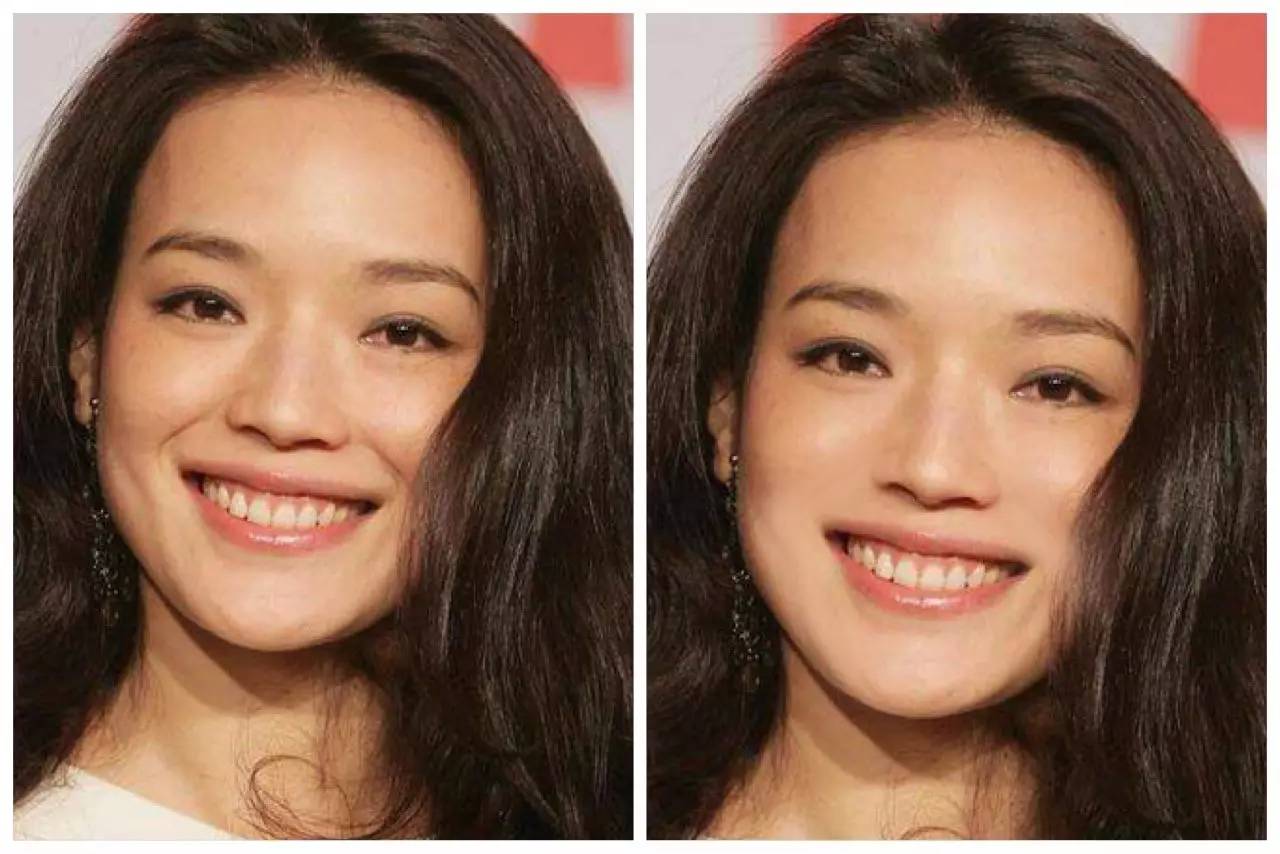 30岁淡化法令纹用什么精华,法令纹严重推荐精华