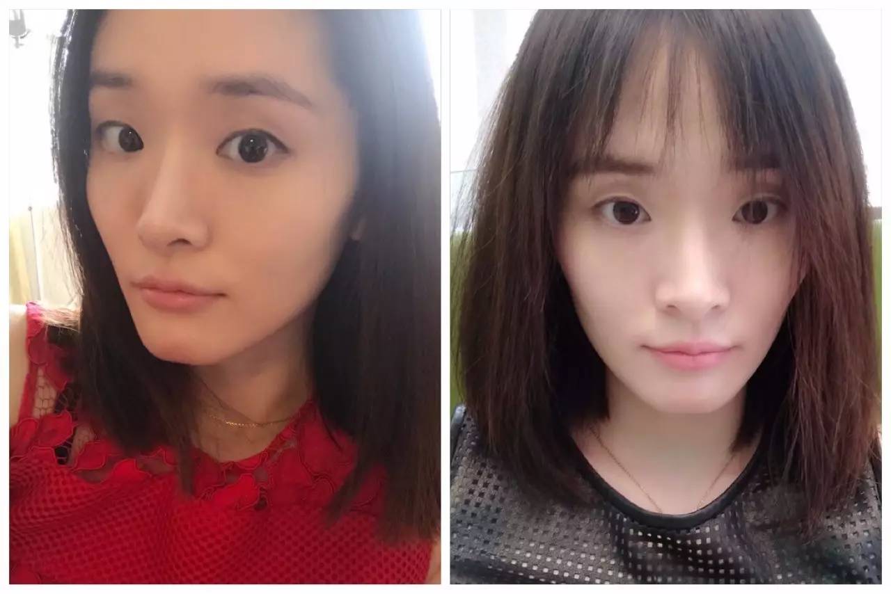 30岁淡化法令纹用什么精华,法令纹严重推荐精华