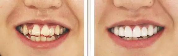 30岁淡化法令纹用什么精华,法令纹严重推荐精华