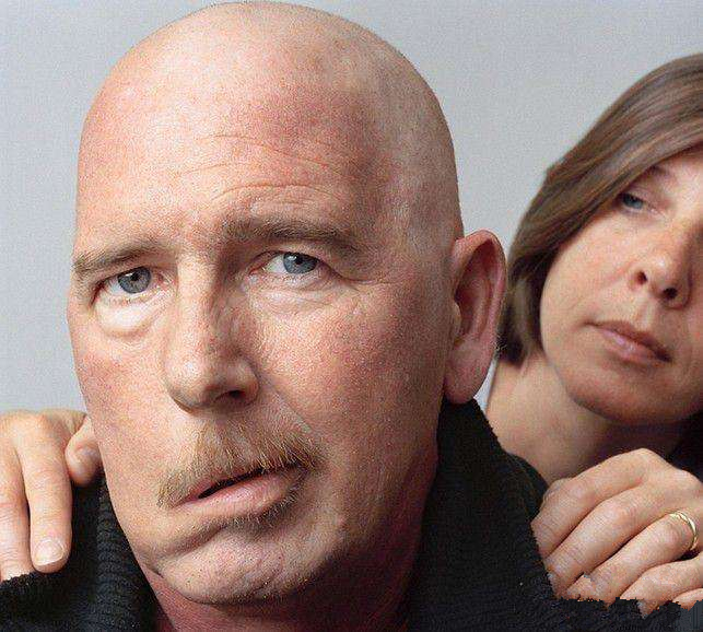 脑溢血很严重可以醒过来吗,高血压糖尿病脑出血会好起来吗