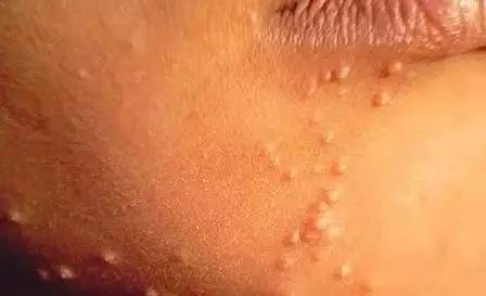 揭秘丨美容院绝不会告诉你的事，看了你还想纹唇吗？