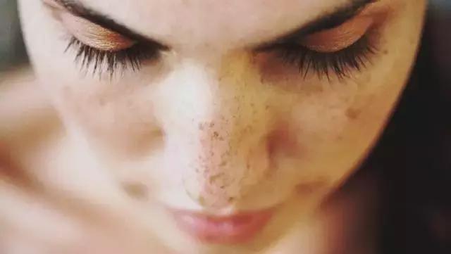 激素脸为什么越来越痒,怀孕激素脸越来越严重