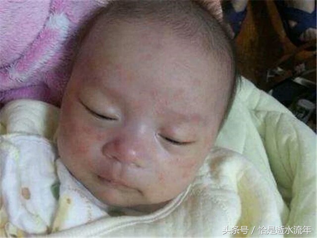 妈妈注意这些食物别给宝宝吃,妈妈饮食不当导致宝宝过敏怎么办