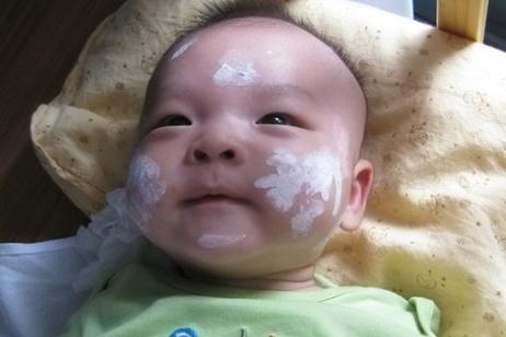 老月嫂的100个小妙招,月嫂怎样解决宝宝湿疹问题