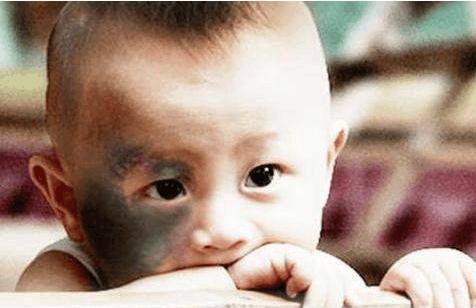 孕妇胎儿胎位不正是怎么办,37周加胎儿未入盆一般几周会入盆