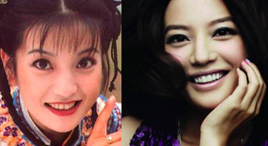 30岁淡化法令纹用什么精华,法令纹严重推荐精华