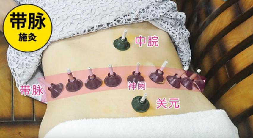 做艾灸都应该知道的4组穴位!可调理一切妇科病!