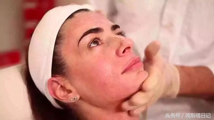 美塑微针真的有用吗,微针美塑有效果